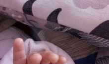 婴儿断掌图片,罕见遗传现象的医学解读