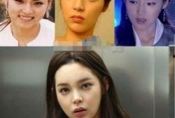 韩国明星整容 八卦,揭秘娱乐圈的美丽秘密与争议