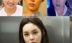 韩国明星整容 八卦,揭秘娱乐圈的美丽秘密与争议